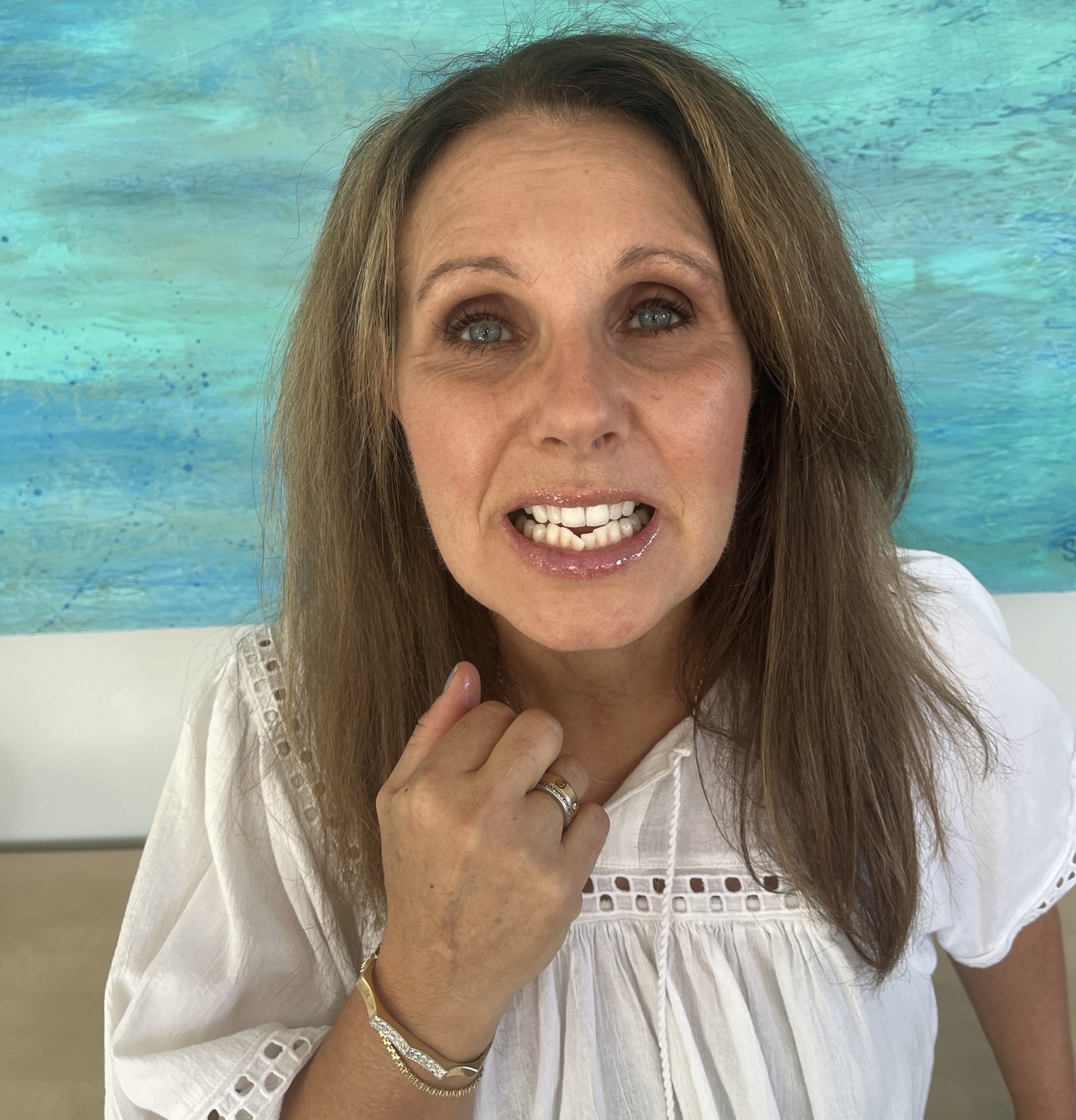 teeth straigntening